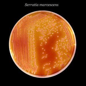 serratia marcescens pronunciation|Tile Grout Turning Red or Pink: Here’s Why .
